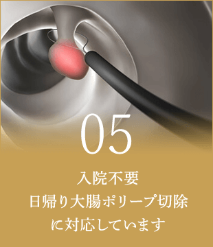 入院不要 日帰り大腸ポリープ切除に対応しています