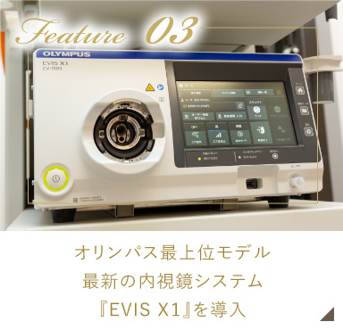 オリンパス最上位モデル最新の内視鏡システム『EVIS X１』を導入